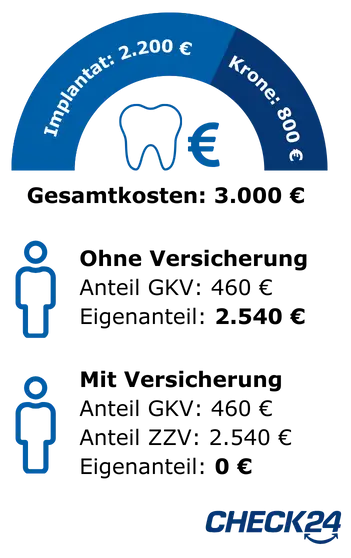 Grafik, die die Kosten für Zahnbehandlungen vergleicht. Ein blauer Halbkreis zeigt auf der linken Seite 'Implantat: 2.200 €' und auf der rechten Seite 'Krone: 800 €'. In der Mitte des Halbkreises befindet sich ein Zahn-Symbol mit einem Euro-Zeichen daneben. Unterhalb des Halbkreises sind zwei stilisierte Personen-Symbole übereinander angeordnet. Das obere zeigt eine Person ohne Zahnzusatzversicherung. Bei ihr kommt die gesetzliche Krankenkasse für 460 Euro der Kosten auf. Den Rest (2.540 Euro) muss die Person als Eigenanteil selbst tragen. Die untere Person zeigt ein Beispiel mit einer Zahnzusatzversicherung bei Leistung von 100 Prozent für Implantate. Wie auch bei der ersten Person übernimmt die gesetzliche Krankenkasse 460 Euro. Allerdings kommt nun die Zahnzusatzversicherung für die verbleibenden 2.540 Euro auf. Die Person hat also keinen Eigenanteil. Unten rechts im Bild ist das CHECK24-Logo.