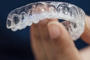 Eine Person hält eine Invisalign-Schiene in der Hand